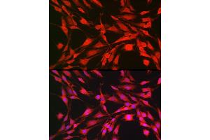Immunofluorescence analysis of C6 cells using p70 S6 Kinase 1 Rabbit pAb (ABIN7270029) at dilution of 1:100 (40x lens).