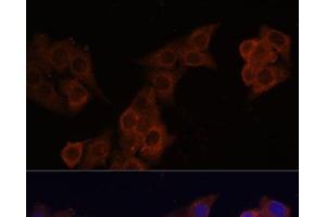Immunofluorescence analysis of HeLa cells using DCN Polyclonal Antibody at dilution of 1:100 (40x lens).