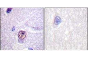 Immunohistochemistry analysis of paraffin-embedded human brain tissue, using SF1 (Ab-82) Antibody. (Splicing Factor 1 anticorps  (AA 48-97))