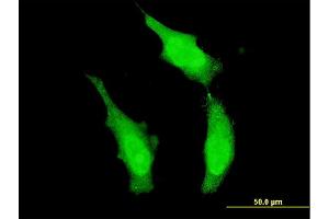 Immunofluorescence of monoclonal antibody to DND1 on HeLa cell. (DND1 anticorps  (AA 167-260))