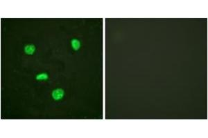 Immunofluorescence analysis of HeLa cells, using Histone H3.