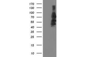 Western Blotting (WB) image for anti-Katanin P80 (WD Repeat Containing) Subunit B 1 (KATNB1) antibody (ABIN1498992) (KATNB1 anticorps)