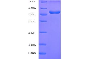 SDS-PAGE (SDS) image for Abhydrolase Domain Containing 11 (ABHD11) (AA 1-307), (full length) protein (His-SUMO Tag) (ABIN5711511)