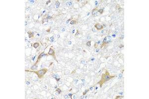 Immunohistochemistry of paraffin-embedded rat brain using IL22 antibody at dilution of 1:100 (40x lens). (IL-22 anticorps)