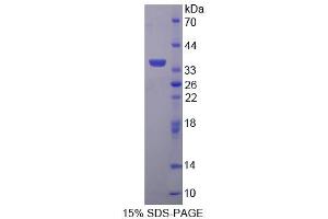 SDS-PAGE analysis of Human TP Protein. (TBXA2R Protéine)