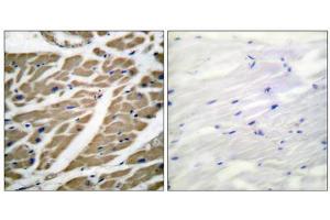 Immunohistochemical analysis of paraffin-embedded human heart tissue using Sodium Channel-pan antibody (ABIN5976507). (Sodium Channel anticorps  (Internal Region, pan))