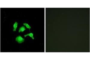 Immunofluorescence analysis of HepG2 cells, using TSC22D1 Antibody . (TSC22D1 anticorps  (N-Term))