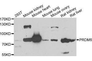Western blot analysis of extracts of various cell lines, using PRDM5 antibody.