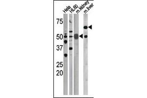 The anti-Phospho-CDC25A-S75 Pab (ABIN389531 and ABIN2839579) is used in Western blot to detect Phospho-CDC25A-S75 in, form left to right, Hela, HL60, mouse kidney, and mouse liver tissue lysates. (CDC25A anticorps  (pSer75))
