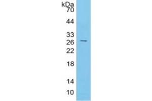 WB of Protein Standard: different control antibodies against Highly purified E.