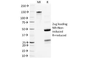 SDS-PAGE Analysis Purified Neurofilament Mouse Monoclonal Antibody (NR-4). (NEFL anticorps)