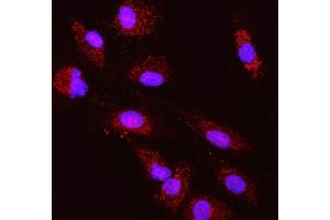IF analysis of TST using anti-TST antibody (ABIN7599105). (TST anticorps  (AA 1-220))