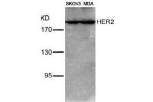 Image no. 3 for anti-Receptor tyrosine-protein kinase erbB-2 (ErbB2/Her2) (Tyr1221), (Tyr1222) antibody (ABIN197225) (ErbB2/Her2 anticorps  (Tyr1221, Tyr1222))