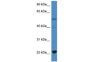 Western Blot showing IL18 antibody used at a concentration of 1 ug/ml against Hela Cell Lysate (IL-18 anticorps  (C-Term))