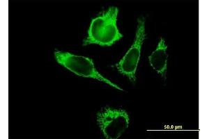 Immunofluorescence of purified MaxPab antibody to TUFM on HeLa cell. (TUFM anticorps  (AA 1-455))