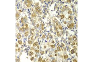 Immunohistochemistry (IHC) image for anti-Tumor Necrosis Factor alpha (TNF alpha) (AA 1-233) antibody (ABIN3020863) (TNF alpha anticorps  (AA 1-233))