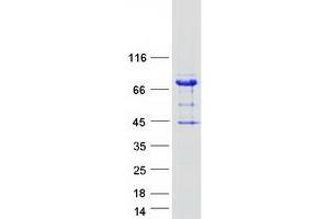 Validation with Western Blot