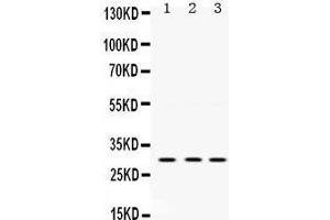 Western Blotting (WB) image for anti-Protein Kinase, AMP-Activated, beta 2 Non-Catalytic Subunit (PRKAB2) (AA 56-89), (N-Term) antibody (ABIN3043907)