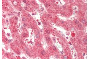 Rabbit Anti-GC antibody Catalog Number: ARP61151 Formalin Fixed Paraffin Embedded Tissue: Human Liver Primary antibody Concentration: 1:100 Secondary Antibody: Donkey anti-Rabbit-Cy3 Secondary Antibody Concentration: 1:200 Magnification: 20x Exposure Time: 0.