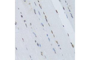 Immunohistochemistry of paraffin-embedded mouse skeletal muscle using NFKB2 Antibody.