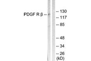 Western Blotting (WB) image for anti-Platelet Derived Growth Factor Receptor beta (PDGFRB) (AA 991-1040) antibody (ABIN2888856)