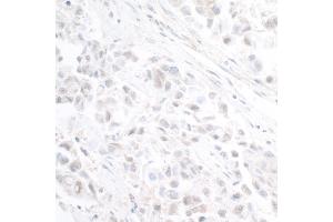 anti-Cleavage and Polyadenylation Specific Factor 3-Like (CPSF3L) (AA 550-600) antibody