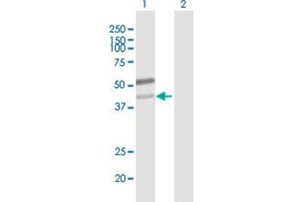B3GNT6 anticorps  (AA 1-384)