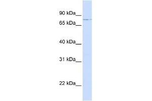 LCP1 antibody used at 1 ug/ml to detect target protein. (LCP1 anticorps)