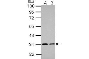 WB Image Sample (30 ug of whole cell lysate) A: A431 B: HeLa 10% SDS PAGE antibody diluted at 1:1000 (ETFA anticorps  (Center))