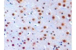 DAB staining on IHC-P; Samples: Mouse Cerebrum Tissue (IRF1 anticorps  (AA 44-319))