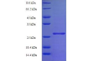 SDS-PAGE (SDS) image for Histone Cluster 1, H2bd (HIST1H2BD) (AA 2-126) protein (His-SUMO Tag) (ABIN5709659)