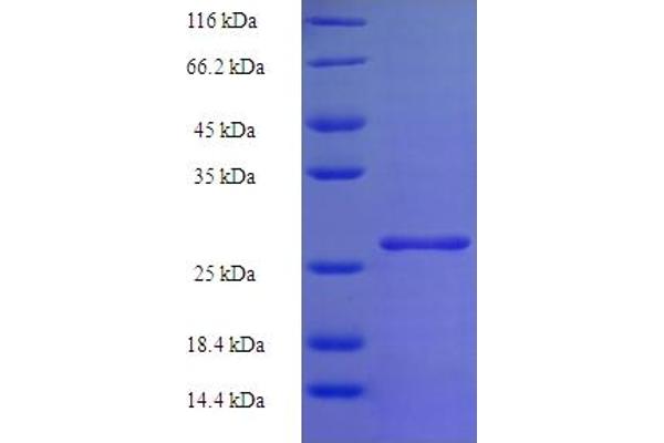 HIST1H2BD Protein (AA 2-126) (His-SUMO Tag)