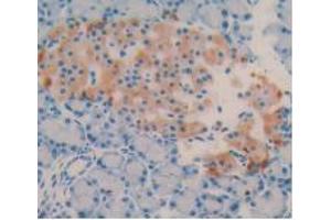 DAB staining on IHC-P; Samples: Rat Pancreas Tissue (Vitamin D-Binding Protein anticorps  (AA 209-394))