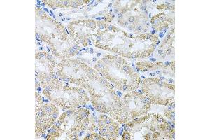 Immunohistochemistry of paraffin-embedded mouse kidney using TARS antibody (ABIN6132713, ABIN6148858, ABIN6148859 and ABIN6222758) at dilution of 1:100 (40x lens). (TARS anticorps  (AA 1-230))