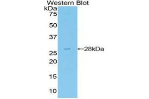 Western blot analysis of the recombinant protein. (FRS2 anticorps  (AA 239-449))