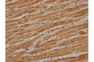 IHC image of ABIN7140227 diluted at 1:700 and staining in paraffin-embedded human heart tissue performed on a Leica BondTM system.