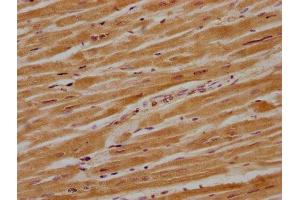 IHC image of ABIN7140227 diluted at 1:700 and staining in paraffin-embedded human heart tissue performed on a Leica BondTM system. (CACNG8 anticorps  (AA 65-83))