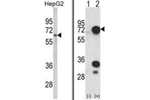(LEFT) Western blot analysis of HNRPL Antibody (C-term) in HepG2 cell line lysates (35ug/lane). (HNRNPL anticorps  (C-Term))