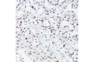 Immunohistochemistry of paraffin-embedded mouse fetal Heart using Islet1 Rabbit mAb (ABIN7268024) at dilution of 1:100 (40x lens).