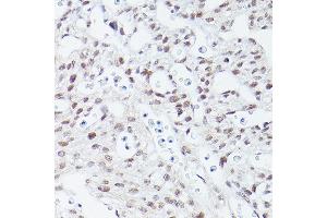 Immunohistochemistry of paraffin-embedded mouse fetal Heart using Islet1 Rabbit mAb (ABIN7268024) at dilution of 1:100 (40x lens). (ISL1 anticorps)