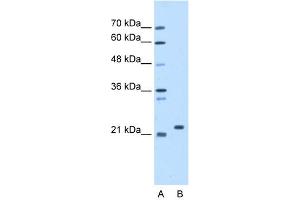 WB Suggested Anti-SDF2 Antibody Titration:  1. (SDF2 anticorps  (N-Term))
