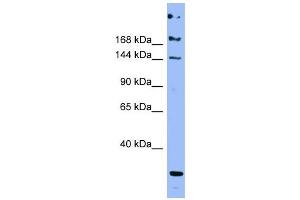 ApoB antibody used at 1 ug/ml to detect target protein.