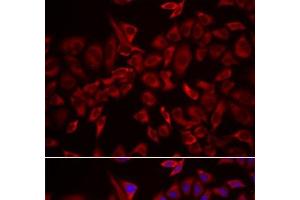Immunofluorescence analysis of HeLa cells using CSRP3 Polyclonal Antibody (CSRP3 anticorps)
