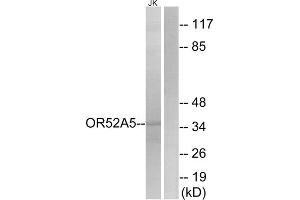 Western blot analysis of extracts from Jurkat cells, using OR52A5 antibody. (OR52A5 anticorps  (Internal Region))