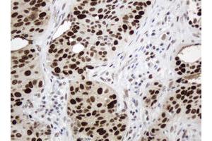 Image no. 4 for anti-Proliferating Cell Nuclear Antigen (PCNA) antibody (ABIN1500061) (PCNA anticorps)