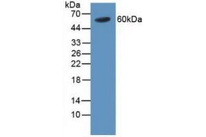 Detection of TRAF4 in Human Blood Cells using Polyclonal Antibody to TNF Receptor Associated Factor 4 (TRAF4)