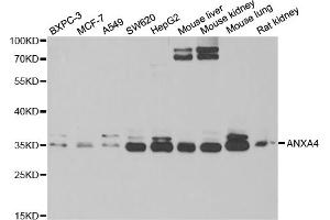 Western blot analysis of extracts of various cell lines, using ANXA4 antibody (ABIN5973706) at 1/1000 dilution. (Annexin IV anticorps)