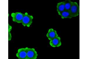 Immunofluorescence analysis of CRC cells using PRKCA antibody (ABIN4904772). (PKC alpha anticorps)