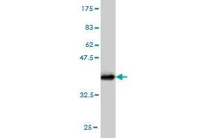 Western Blot detection against Immunogen (36. (STAR anticorps  (AA 81-180))