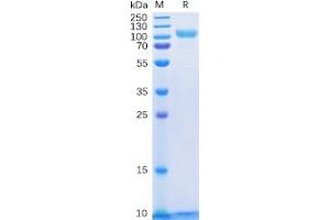 Human HER3 Protein, His Tag on SDS-PAGE under reducing condition.